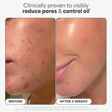 Paula's Choice SKIN PERFECTING 2% BHA Liquid Exfoliant with Salicylic Acid