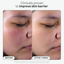 Paula's Choice SKIN PERFECTING 2% BHA Liquid Exfoliant with Salicylic Acid